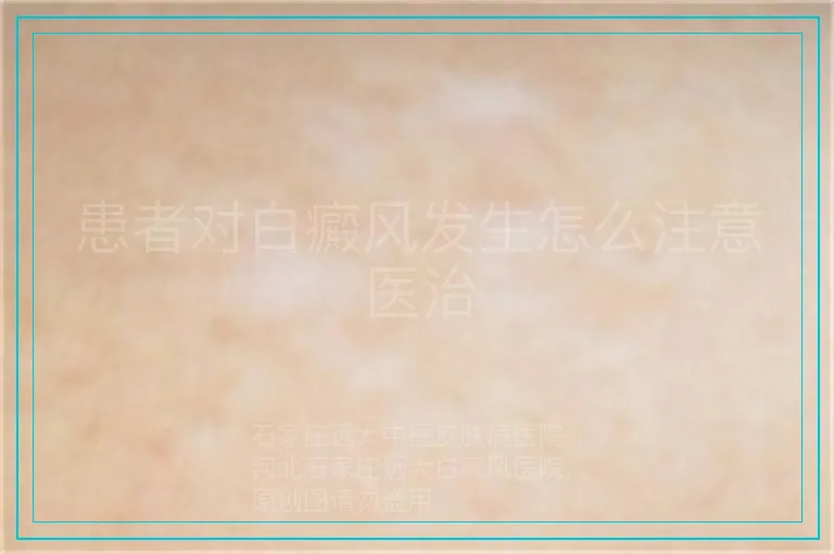 患者对白癜风发生怎么注意医治