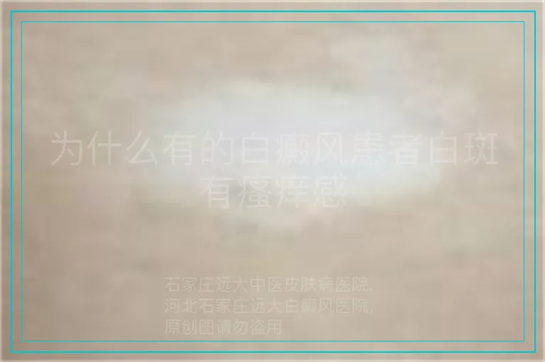 为什么有的白癜风患者白斑有瘙痒感