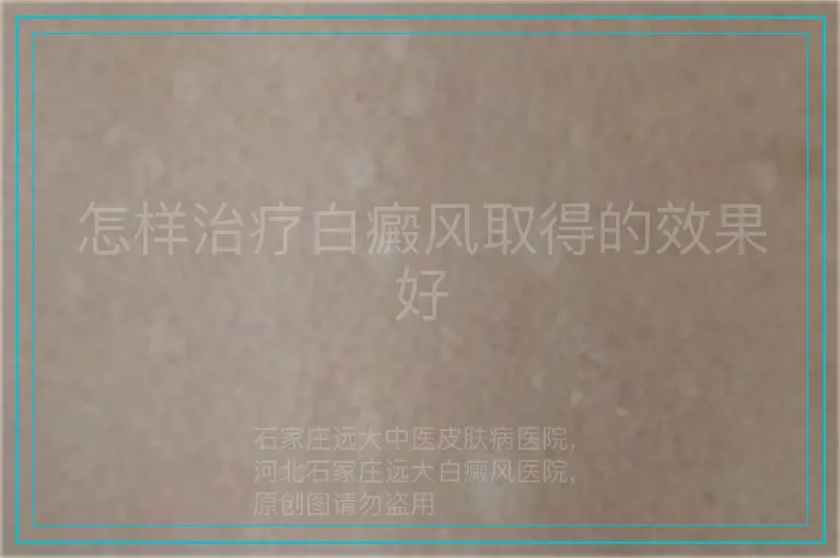 怎样治疗白癜风取得的效果好