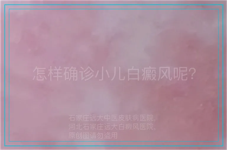 怎样确诊小儿白癜风呢？