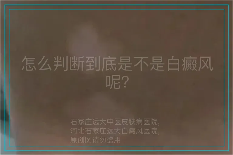 怎么判断到底是不是白癜风呢？