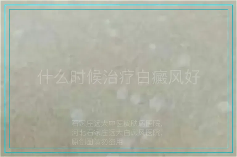 什么时候治疗白癜风好