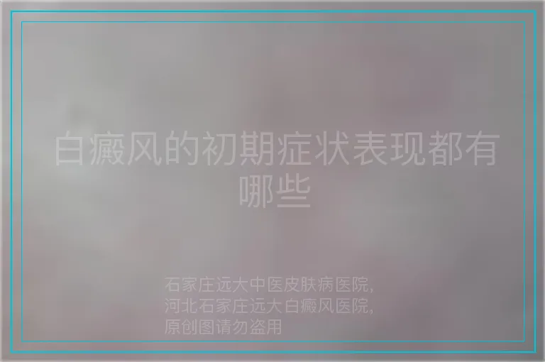 白癜风的初期症状表现都有哪些