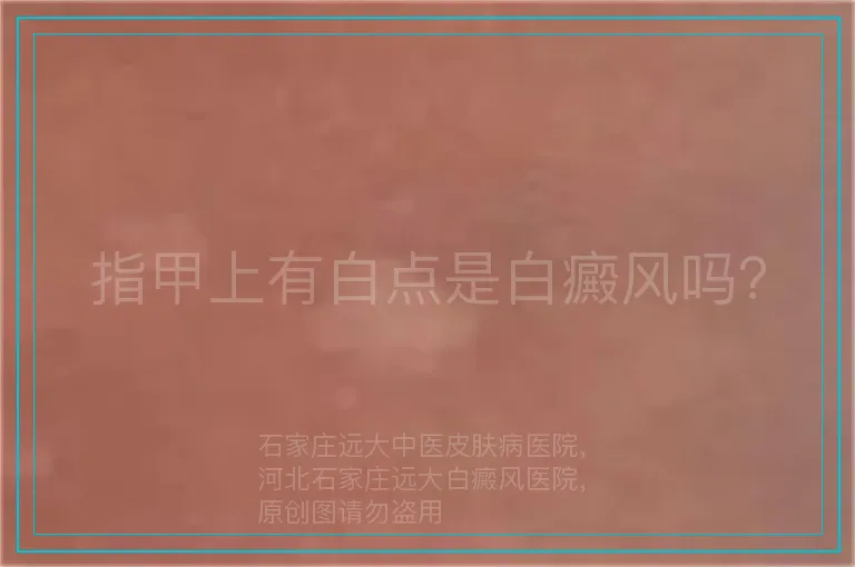 指甲上有白点是白癜风吗？
