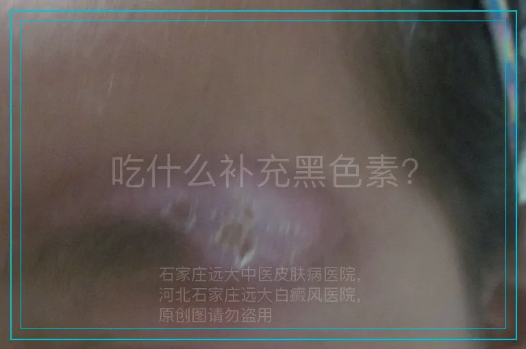 吃什么补充黑色素?
