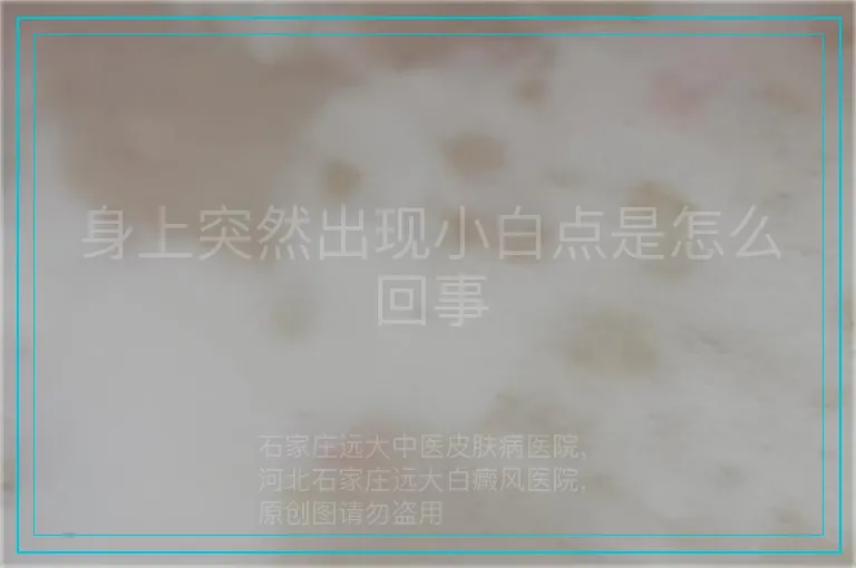 身上突然出现小白点是怎么回事