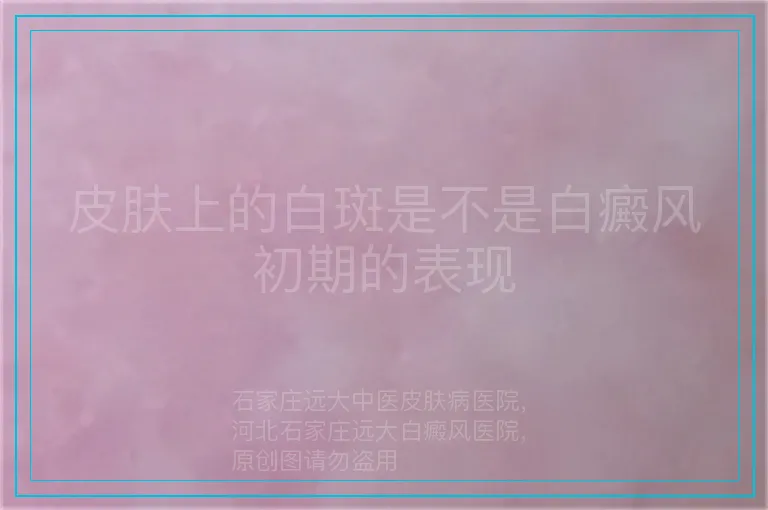 皮肤上的白斑是不是白癜风初期的表现