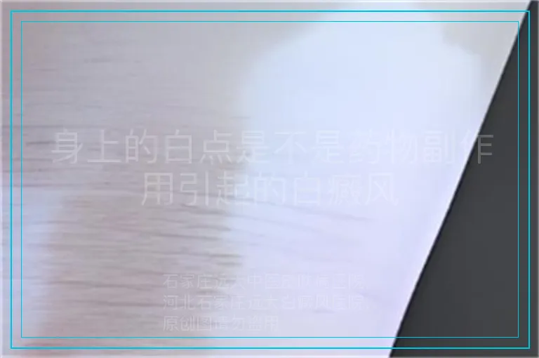 身上的白点是不是药物副作用引起的白癜风
