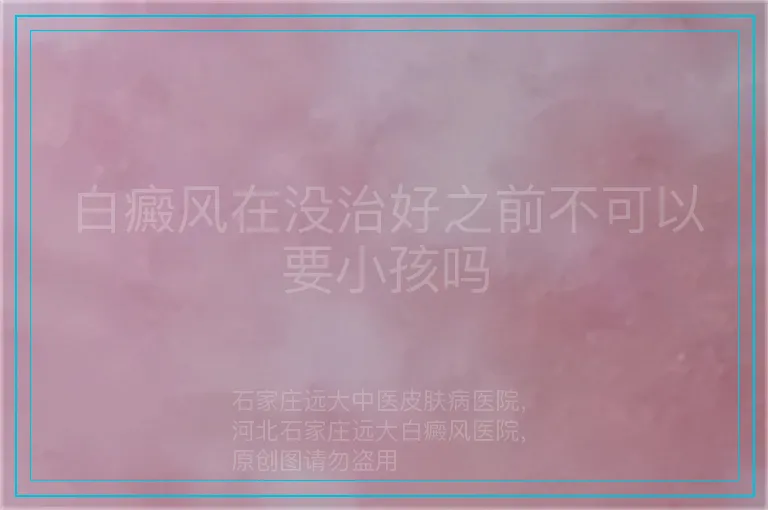 白癜风在没治好之前不可以要小孩吗