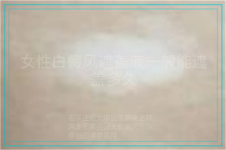 女性白癜风遮盖液一般能遮盖多久