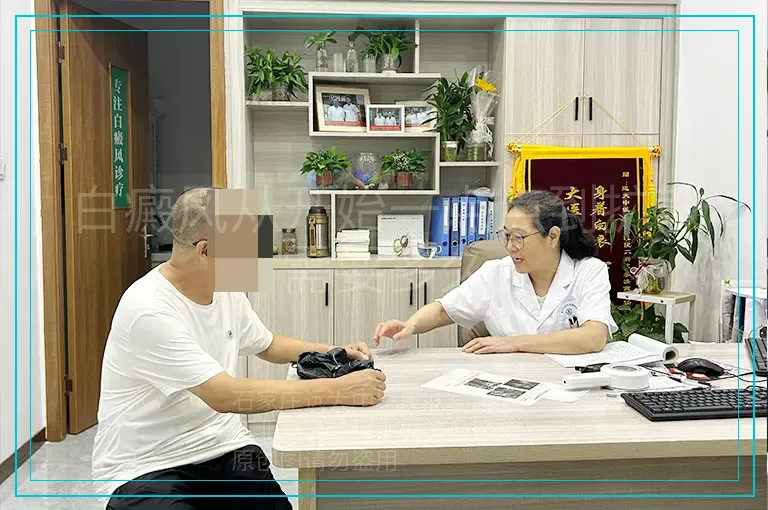 白癜风从开始一点点到扩散需要多久
