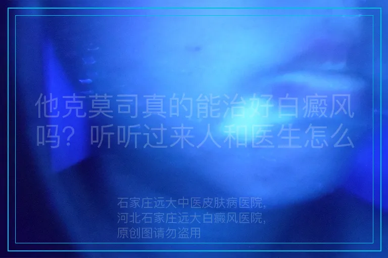 他克莫司真的能治好白癜风吗?听听过来人和医生怎么说