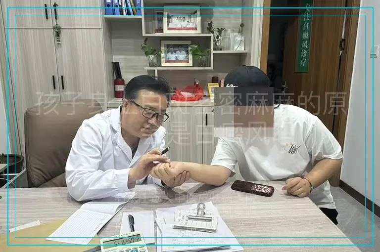 孩子身上白斑密密麻麻的原因,会是白癜风吗