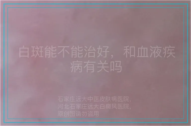 白斑能不能治好，和血液疾病有关吗