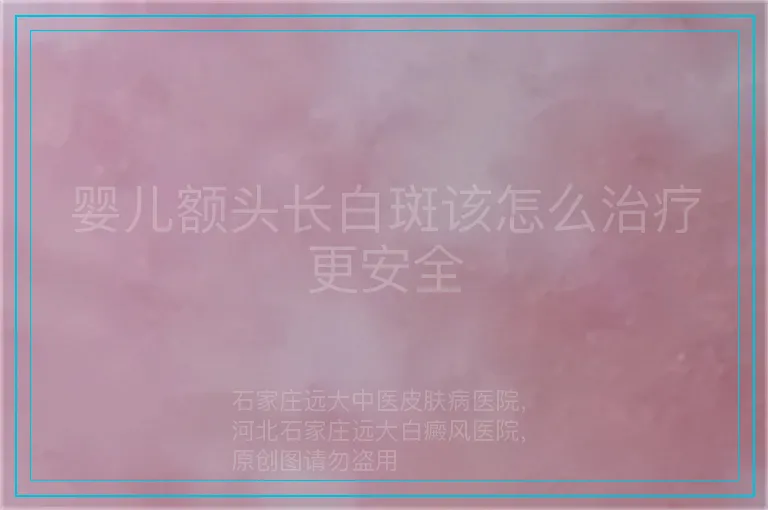 婴儿额头长白斑该怎么治疗更安全