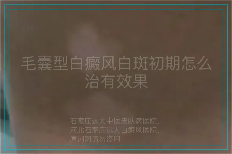 毛囊型白癜风白斑初期怎么治有效果