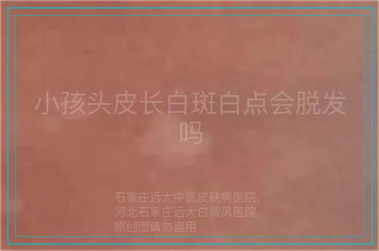 小孩头皮长白斑白点会脱发吗