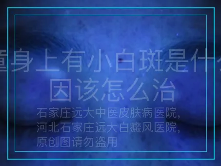 儿童身上有小白斑是什么原因该怎么治