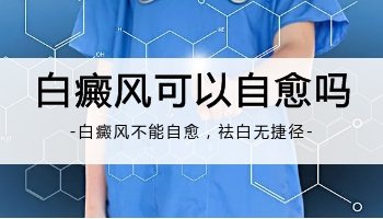 小孩身上长白癜风不吃药能治疗好吗，用什么仪器