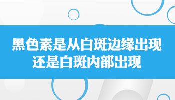 儿童胳膊和肩膀长指甲盖大白癜风吃中药治疗需要多久能恢复好