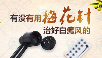 小孩身上长大面积白癜风不吃药能治疗好吗，用什么仪器