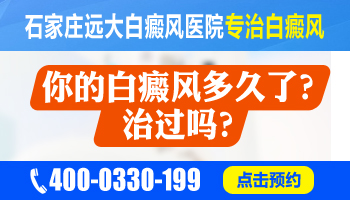 小孩身上发现圆形白斑都是怎么治疗的，哪种方法安全