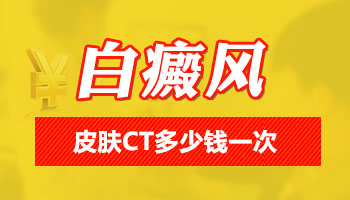 小孩胳膊和肩膀长指甲盖大白癜风治一次要花多少钱，都是什么药