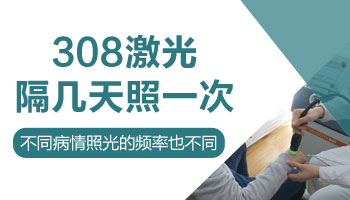 儿童胳膊和肩膀长硬币大白癜风只照激光能治疗好吗，配合药物是不是好得快