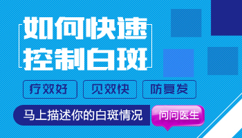 儿童身上长白癜风怎么治疗，哪种方法好