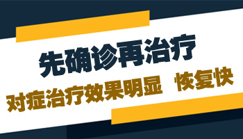 小孩脸部有小面积白癜风用308激光治好后复发几率多大