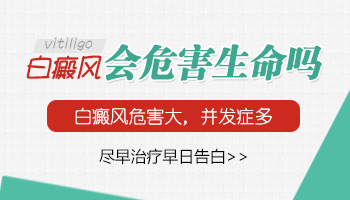 儿童身上发现小面积白癜风照308激光治疗一个疗程费用多少